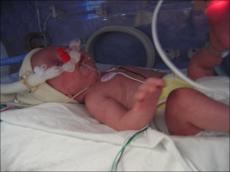 More CPAP